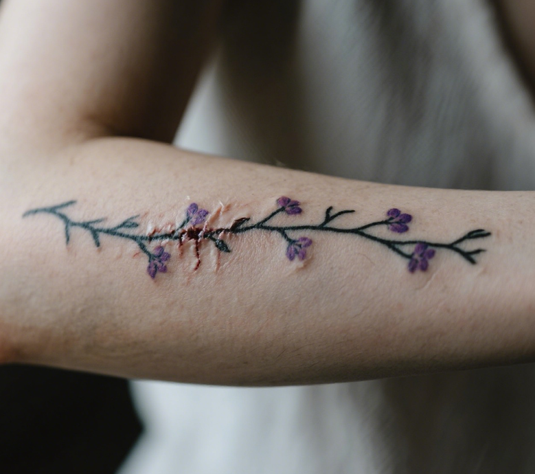 can you tattoo over a scar